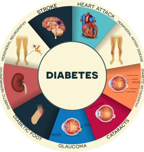 Diabetes Overview 1 768x768 1